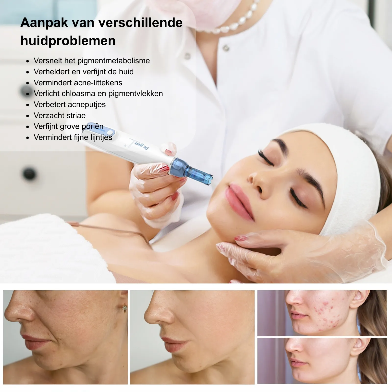 Dr. Pen A9W draadloze dermapen voor microneedling detail