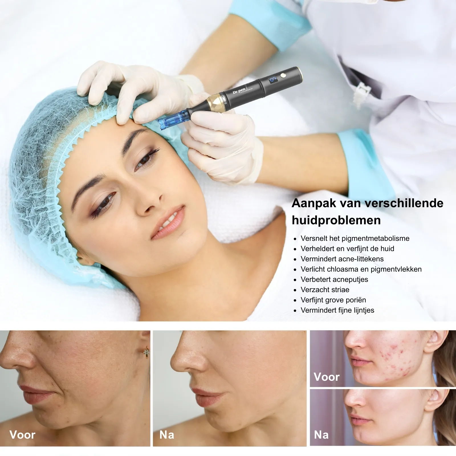 Dr. Pen A8S 2-in-1 bedraad en draadloos dermapen voor microneedling detail