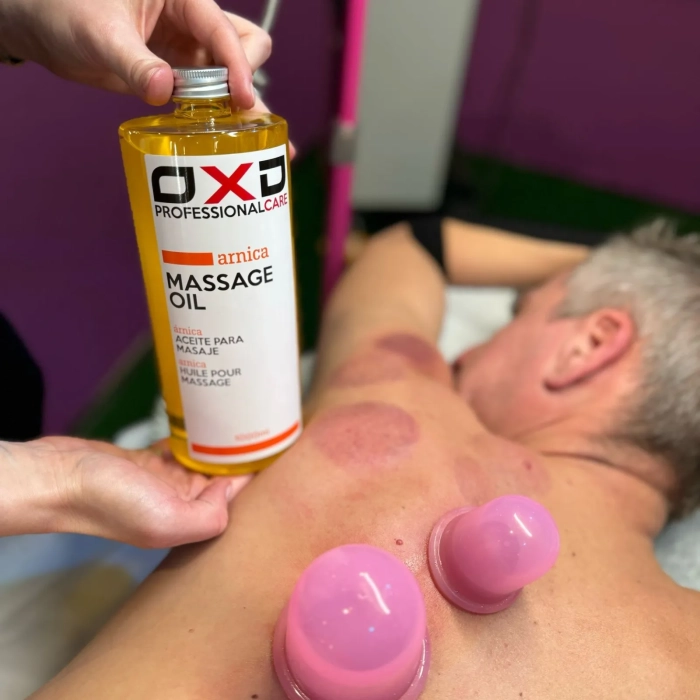 OXD Massageolie Arnica voor cuppingmassage en sneller herstel van de huid – 1000ML kopen bij MedAes