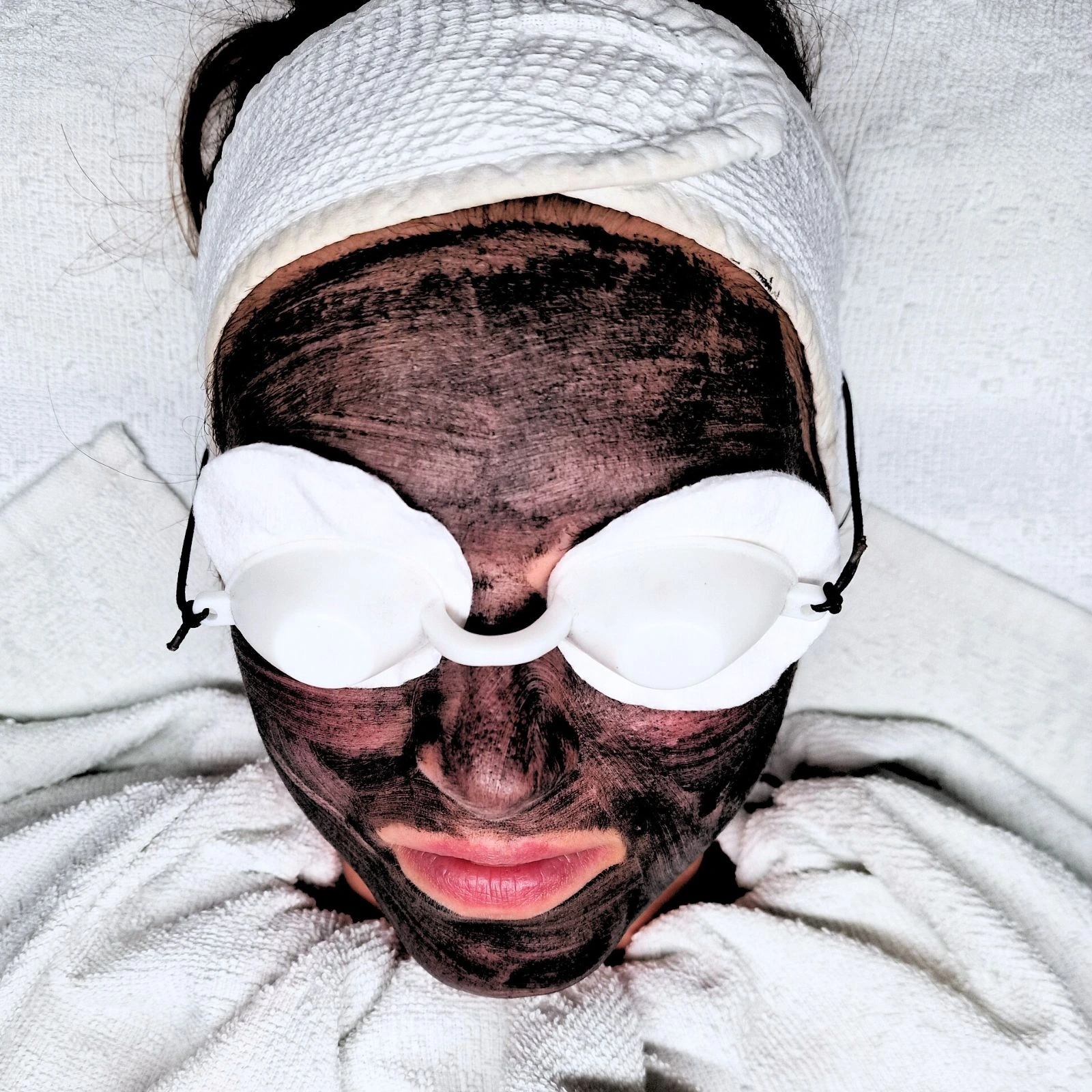 YAG Laser categorie