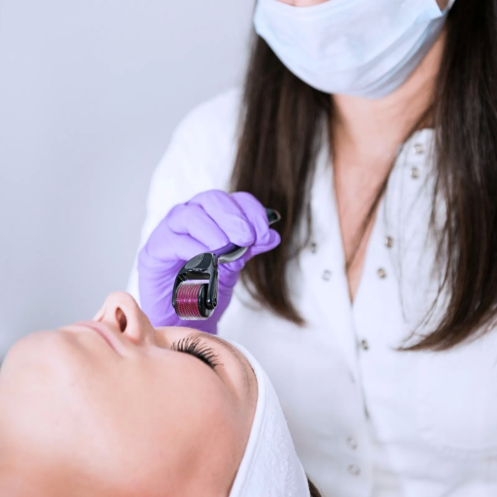 DRS100 dermaroller 540 naalden - 1.00mm vermindert rimpels en pigmentatie - Afbeelding 2