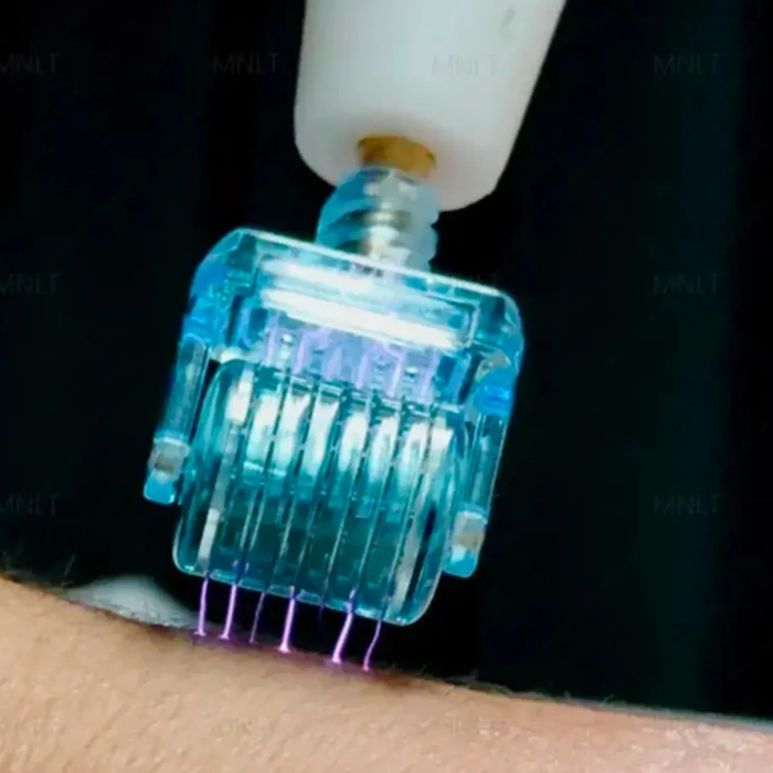 MedAes FusionPlasma Pro - Cold Tip (Plasma Needle Roller)