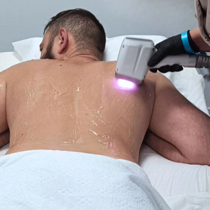 OXD Ultrasound Gel voor IPL en diode laser – Transparant haar verwijderen behandeling met diode laser