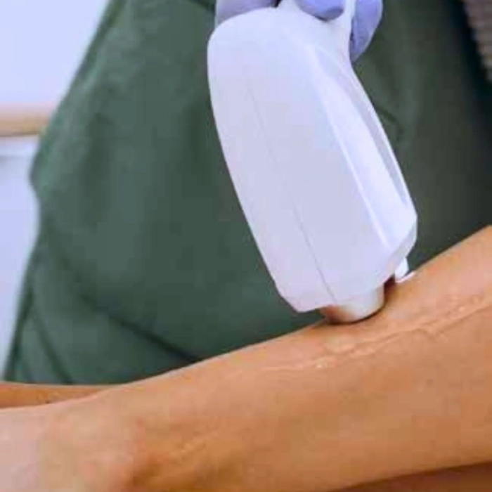 OXD Ultrasound Gel voor IPL en diode laser – Transparant haar verwijderen behandeling met diode laser benen