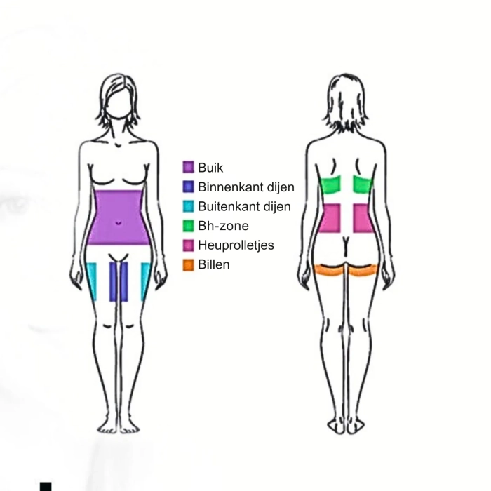 CryoShape 4D Cryolipolyse apparaat voor figuurcorrectie behandelzonen vrouwen