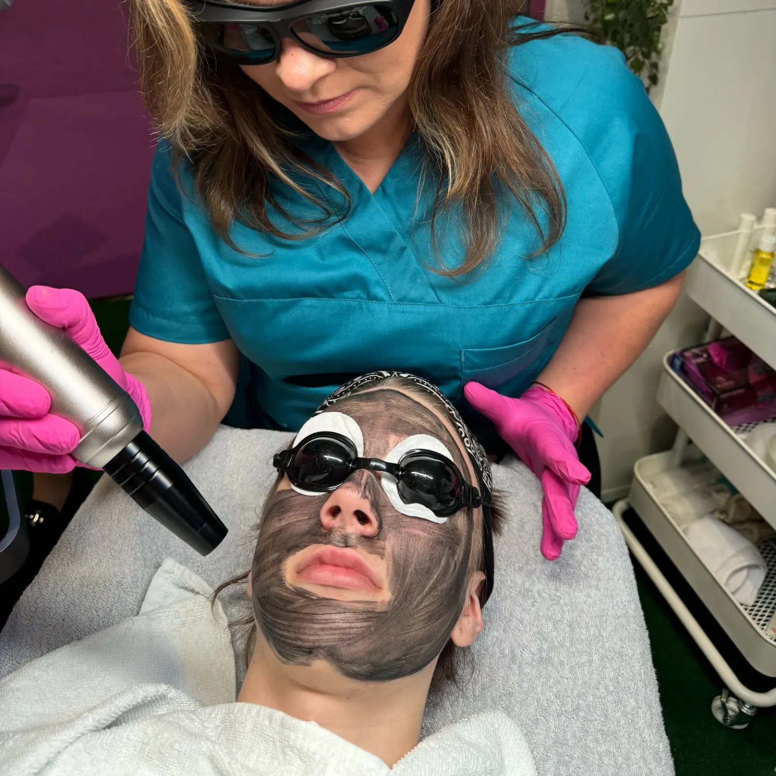 Carbon Peeling categorie