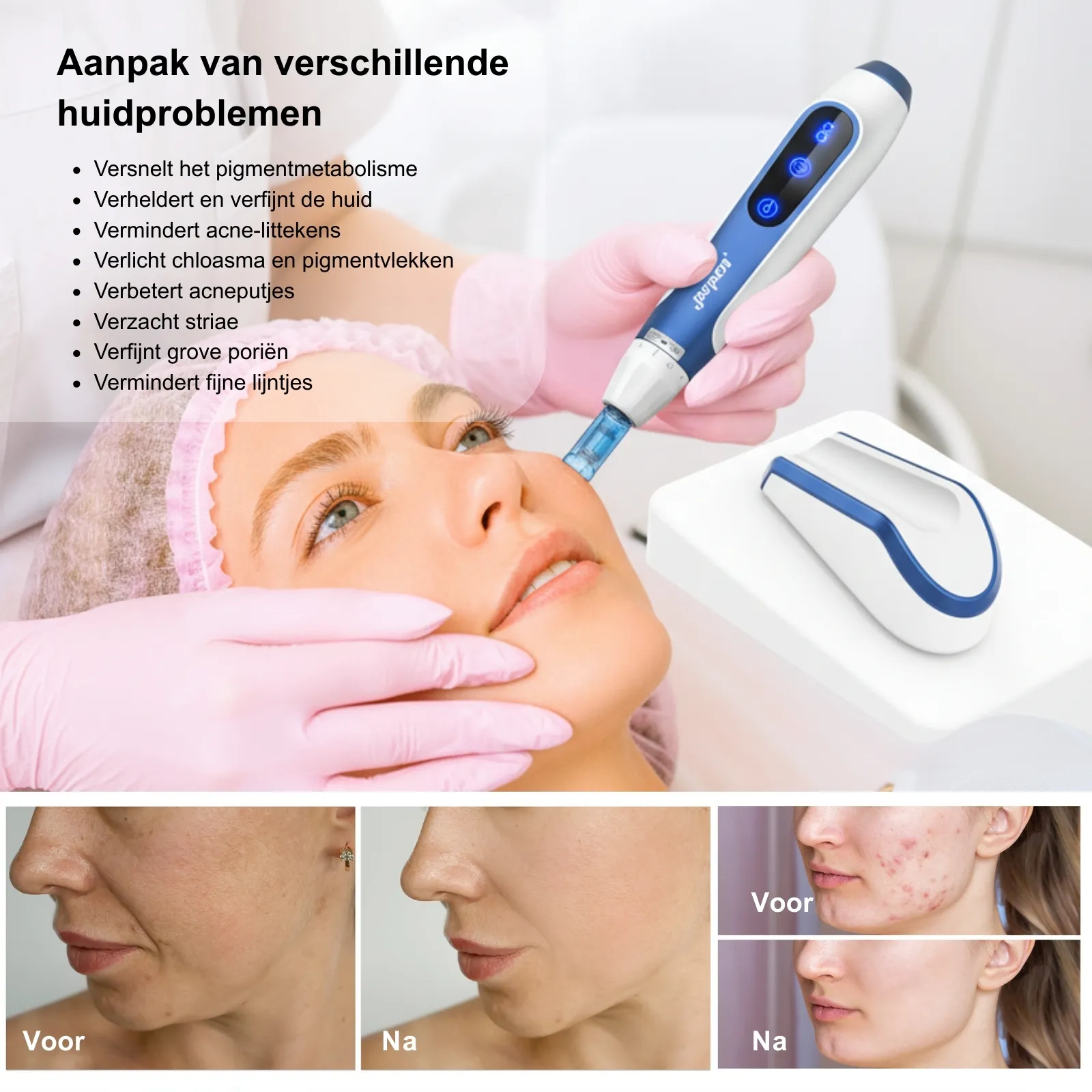 Dr. Pen A11 draadloze dermapen voor microneedling detail