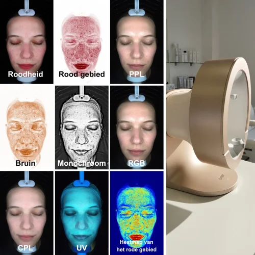 meicet-pro-a-huidanalyse-ai-lichtanalyse